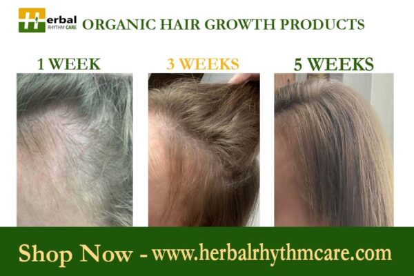 ROSEMARY AND CASTOR OIL HAIR GROWTH OIL - Image 10