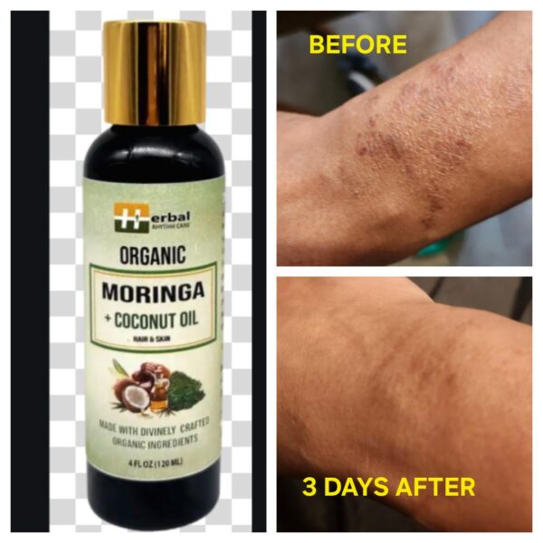 MORINGA & COCONUT BODY OIL - Image 5